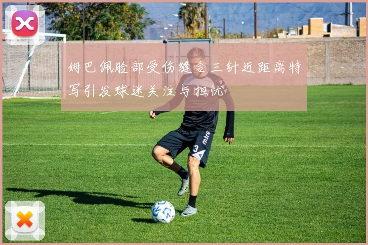 姆巴佩脸部受伤缝合三针近距离特写引发球迷关注与担忧